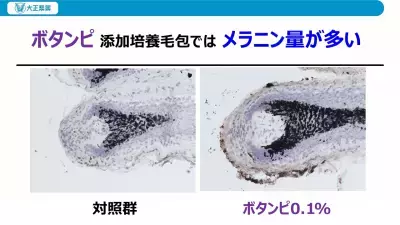 細胞のミトコンドリア活性で“脱・白髪”へ！「老け髪」予防の最新研究を発表