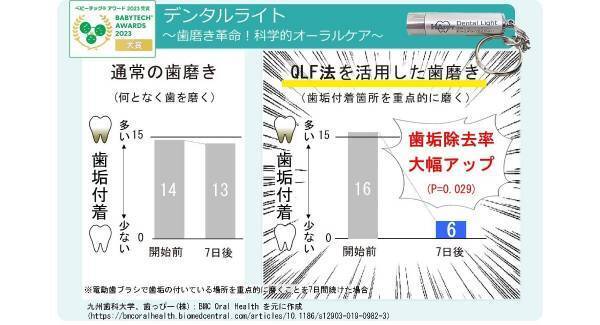 プラークを蛍光で可視化してチェック『デンタルライト』