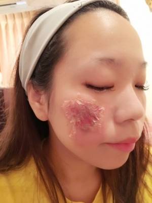 ＜ハロウィン＞リーズナブルでも気合いたっぷり！  簡単にやけどメイクをするテクニック