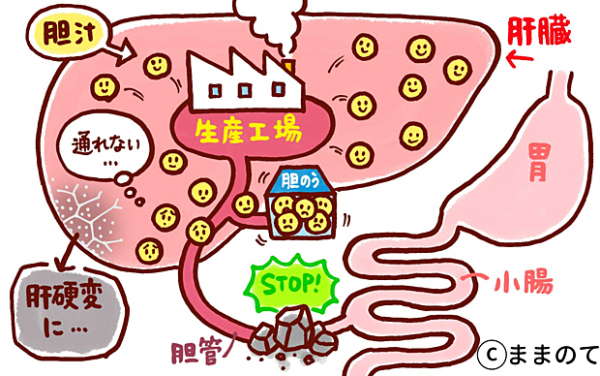 胆道閉鎖症とは 注意するべき3つの症状を知っておこう パパ小児科医コラムvol 16 19年12月3日 ウーマンエキサイト 1 3