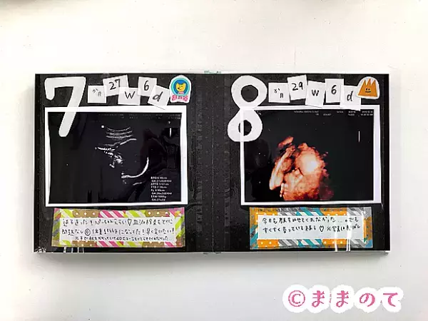 【体験談】エコー写真の保存術！アルバム・データ・フォトブックなどみんなの保存方法をご紹介