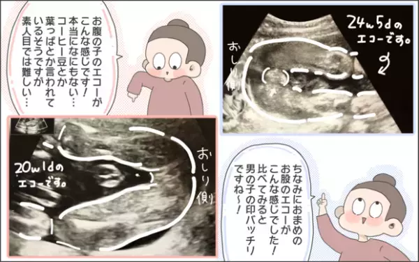 【#22】赤ちゃんの性別が無事判明！かと思いきや…！？ byおかめ