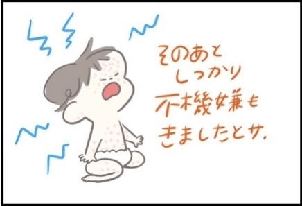 【＃110】なぜこのタイミング？突発性発疹中にグングン成長する赤ちゃん byつぶみ