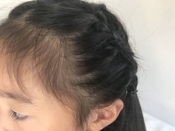 子どもの中途半端な前髪は切らずにアレンジ すっきりまとめるテク３つ ウーマンエキサイト 1 2