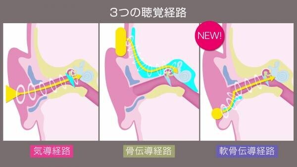 Makuakeにて早くも目標金額1000％達成！！ 骨伝導を超えた！？ 軟骨伝導イヤホン「cheero Otocarti(オトカルティ)」