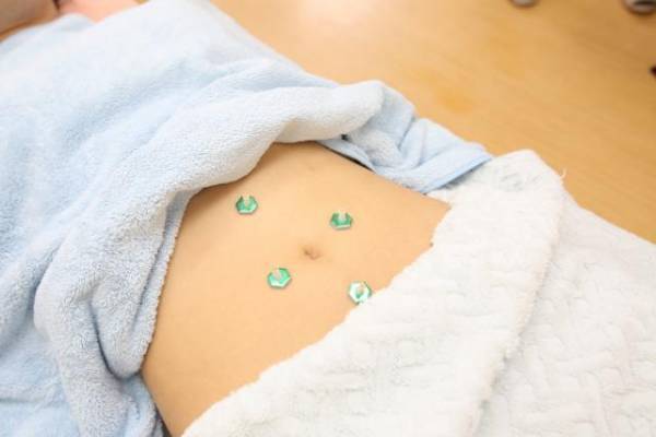 武蔵新城駅から徒歩1分の川崎市中原区にある鍼灸整体治療院！自律神経を整え不眠や逆流性食道炎及び過敏性腸症候群などの慢性的な不調やストレスがでにくい身体づくりや悩みをサポートする『よしだ鍼灸整骨院・整体院』の情報をFindサービスで公開