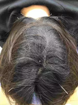 武蔵新城駅から徒歩1分の川崎市中原区にある鍼灸整体治療院！自律神経を整え不眠や逆流性食道炎及び過敏性腸症候群などの慢性的な不調やストレスがでにくい身体づくりや悩みをサポートする『よしだ鍼灸整骨院・整体院』の情報をFindサービスで公開