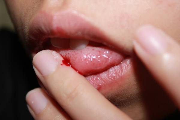 【北海道 東川町】第38回「写真の町」東川賞の受賞作家が決定