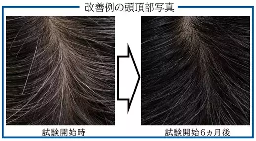 近い未来、白髪が治る時代をつくるべく研究活動を進めます