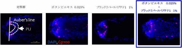 白髪改善（および黒髪の維持）研究の成果を世界最大級の毛髪学会で発表