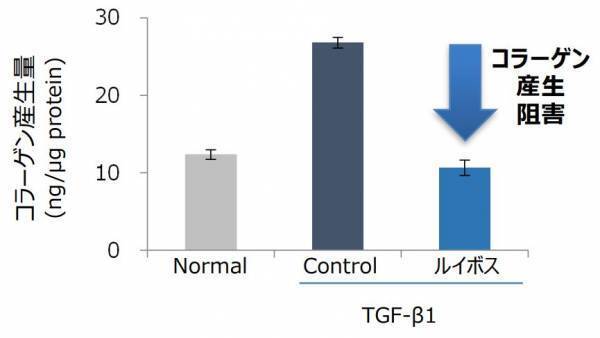 頭皮を柔らかくする可能性を“ルイボス”に発見 ～ 頭皮柔軟成分として特許を取得 ～