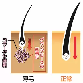 頭皮を柔らかくする可能性を“ルイボス”に発見 ～ 頭皮柔軟成分として特許を取得 ～