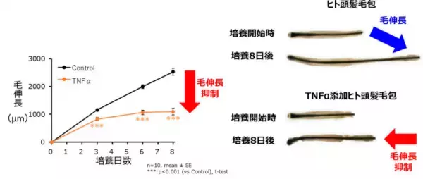 毛髪の成長に欠かせない栄養成分「パントテン酸」が 外部刺激による毛髪の成長阻害を改善する可能性