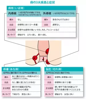 ～大正製薬『腸活と痔に関する意識調査』を実施～