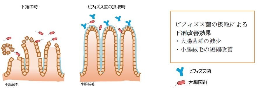 2024年夏「下痢・軟便に関する調査」を実施。お腹をこわした時、腸内環境の改善を意識しているが、なにもしていない人も多い！？