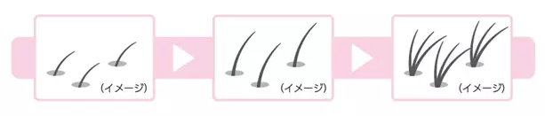 人には聞きづらい女性の髪悩み「分け目の透け感」実態調査