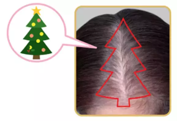 人には聞きづらい女性の髪悩み「分け目の透け感」実態調査