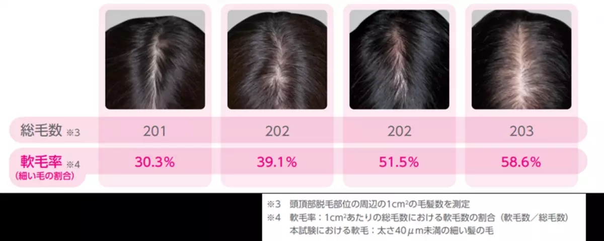 人には聞きづらい女性の髪悩み「分け目の透け感」実態調査