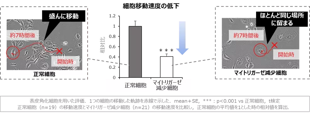 若返りの鍵「マイトリガーゼ」と肌老化の関係を多角的に解明