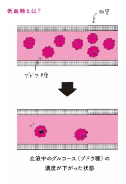 【“異常な眠気” “頭痛” “不安感” “イライラ” “疲労感” “過剰な食欲”… の原因は低血糖?! 】岡城美雪著『「なんだかつらい……」がなくなる かくれ低血糖との付き合い方』2024年9月26日刊行