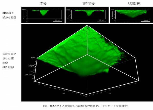 ヒアルロン酸Naマイクロニードルによる皮内深くに成分を届ける性能を3D可視化
