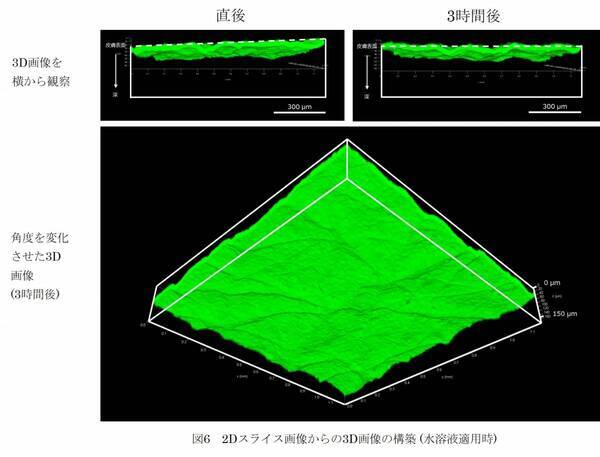 ヒアルロン酸Naマイクロニードルによる皮内深くに成分を届ける性能を3D可視化
