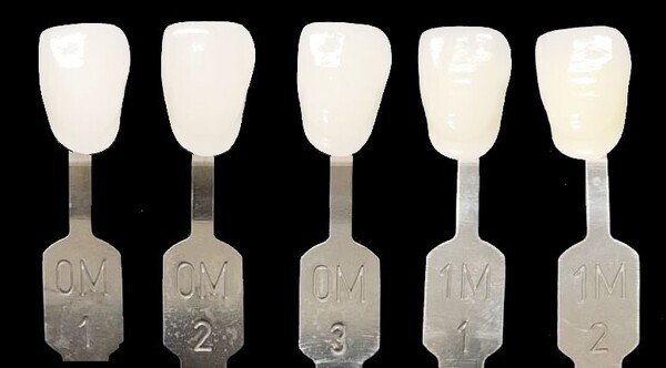 ルミネアーズ治療で美しい歯と最高の笑顔を手に入れた小河麻理子さん（Ms. Brilliant Soul 2024日本代表）、マレーシアで開催された世界大会でのグランプリ受賞おめでとう！