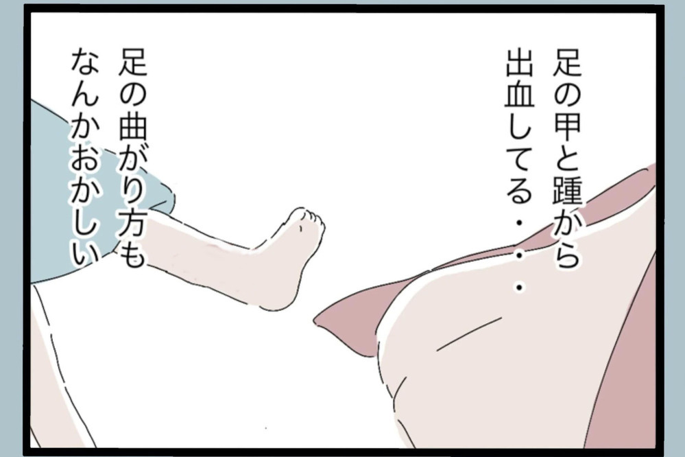 「これどういうこと？」娘の足に大怪我にパニック「何があったか夫に問い詰めた結果…【夫から脱却できますか？ Vol.74】
