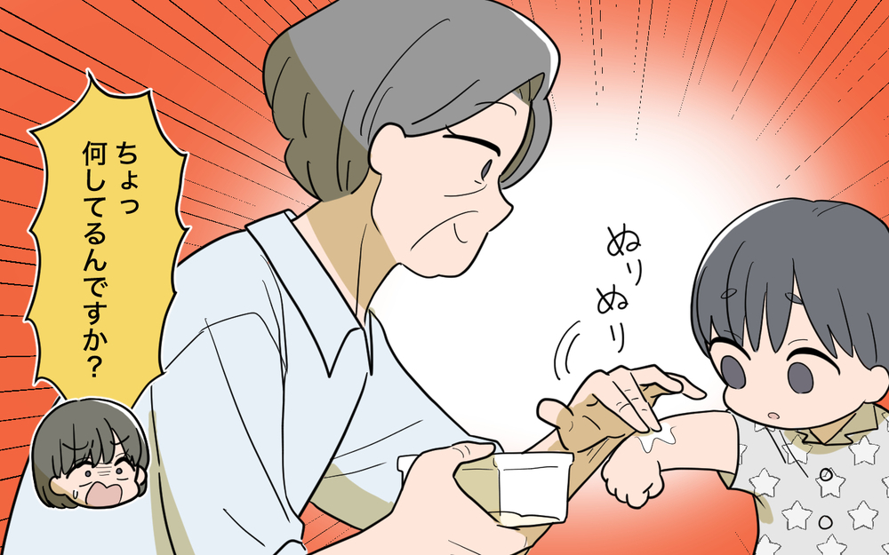 義母「水イボにはじゃがいものすりおろしよ」子どもの肌で勝手に民間療法を試さないで！【じゃがいもすりおろし義母 Vol.5】
