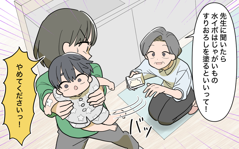 義母「水イボにはじゃがいものすりおろしよ」子どもの肌で勝手に民間療法を試さないで！【じゃがいもすりおろし義母 Vol.5】