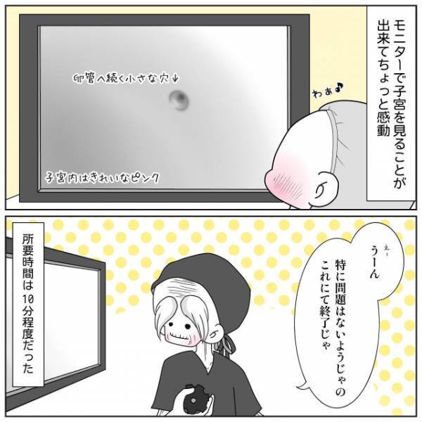 妊活で“子宮鏡検査”を受ける私。その検査の実態とは…【40歳で妊活始めました＃51】