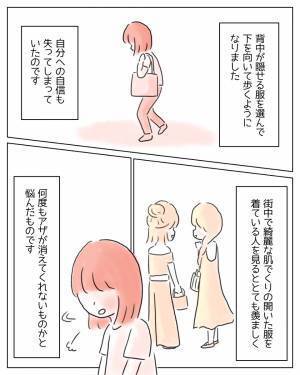 「お願い、どうか消えてよ」背中のアザをコンプレックスに思う私。ある日、‟チャーミングスカー”という言葉を知り…→読者「私も手術痕があって温泉などでよく見られて辛かった」