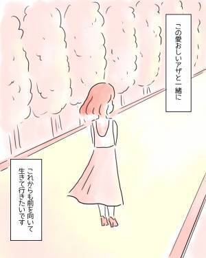 「お願い、どうか消えてよ」背中のアザをコンプレックスに思う私。ある日、‟チャーミングスカー”という言葉を知り…→読者「私も手術痕があって温泉などでよく見られて辛かった」