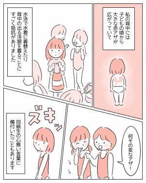 「お願い、どうか消えてよ」背中のアザをコンプレックスに思う私。ある日、‟チャーミングスカー”という言葉を知り…→読者「私も手術痕があって温泉などでよく見られて辛かった」