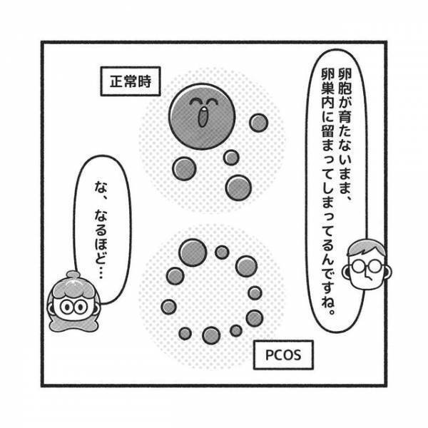 多嚢胞性卵巣症候群”で生理が来ないと判明した私。“根本的な治療法”も確立してなくて…【PCOSだった私が自然妊娠＃4】