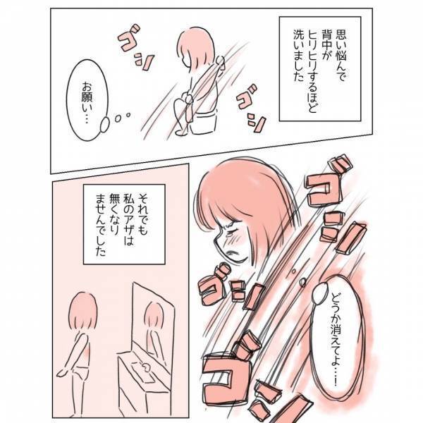 【漫画】『どうか消えて…！』コンプレックスの“アザ”に読者⇒「それだけ悩んだ証拠」「話せる場所がほしい」