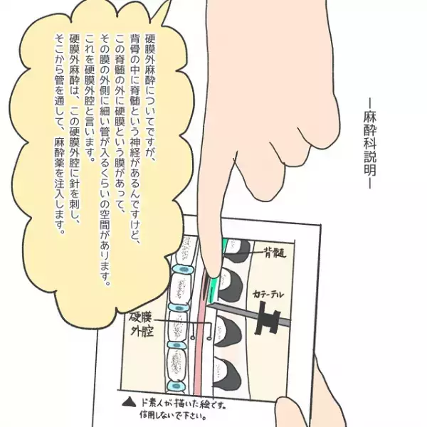「無痛分娩の麻酔が不安…」“注射で気絶”するほど痛みに弱いと相談すると…⇒医師の【予想外な励まし】にむしろ不安増大！？