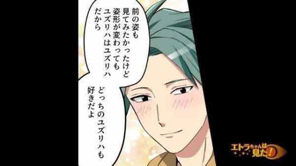 【マスクが外せない…】外見コンプレックスから整形を繰り返す女性…→“整形前の写真”を見た今彼の【予想外の反応】に涙！