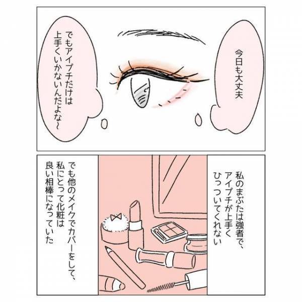 【あれって整形でしょ】“目の整形”をした友人。周囲の＜心ない発言＞に困惑