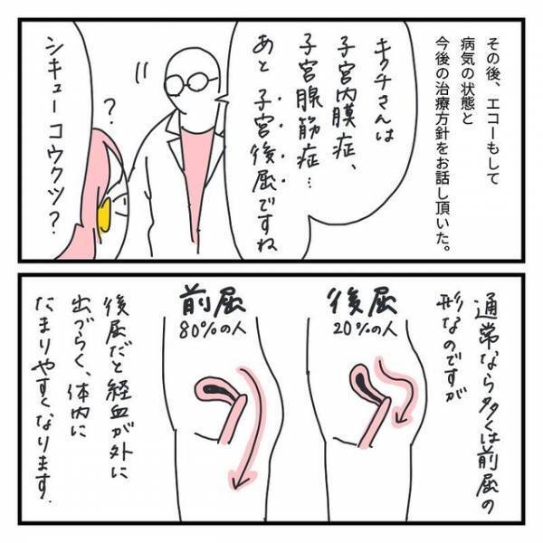 【子宮内膜症】医師「6cmなら手術はしないですよ」薬で治療することに！？⇒読者「勉強になった」