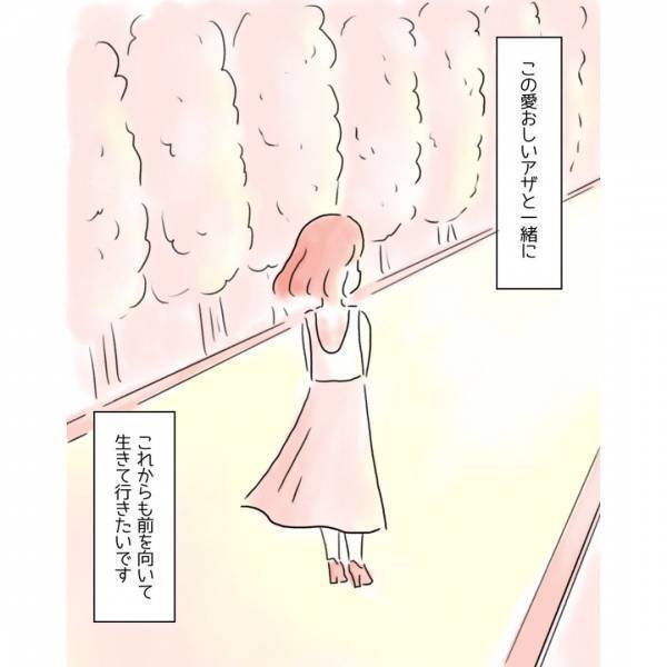 『消えてよ！』背中に痣を持つ女性。露出が多い服を着ようとして…→読者「堂々と生きて欲しい」「自身を持って」