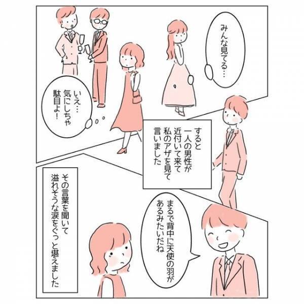 『どうか消えてよ…！』生まれつきの“背中のアザ”が嫌い！→コンプレックスを乗り越えるため【大胆な行動】に出た