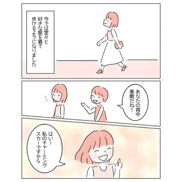 『どうか消えてよ…！』生まれつきの“背中のアザ”が嫌い！→コンプレックスを乗り越えるため【大胆な行動】に出た
