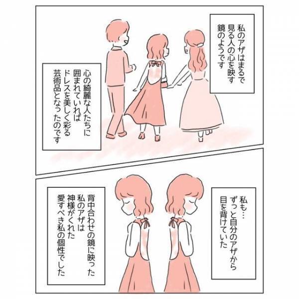 『どうか消えてよ…！』生まれつきの“背中のアザ”が嫌い！→コンプレックスを乗り越えるため【大胆な行動】に出た