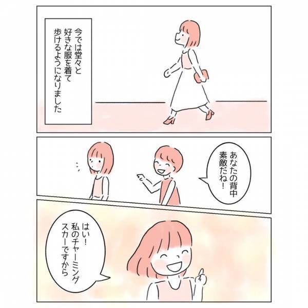 「どうか消えてよ…！」背中がコンプレックスの女性。背中の空いたドレスと着ると⇒「背中に…」男性が【放った一言】とは！？