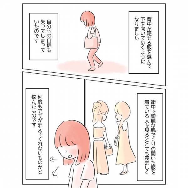 「どうか消えてよ…！」背中がコンプレックスの女性。背中の空いたドレスと着ると⇒「背中に…」男性が【放った一言】とは！？