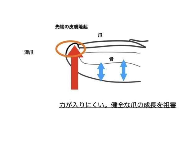 ボールを蹴ると爪が痛い、割れた！　サッカー選手にとって大事なパーツ「足の爪」が与える競技への影響と正しいケア