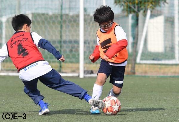 目のかゆみ、鼻のグズグズにさよなら！　サッカー少年を悩ます花粉症、根治するなら「舌下免疫療法」という方法も