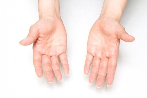 手のむくみが引き起こされる病気とは ウーマンエキサイト 1 5
