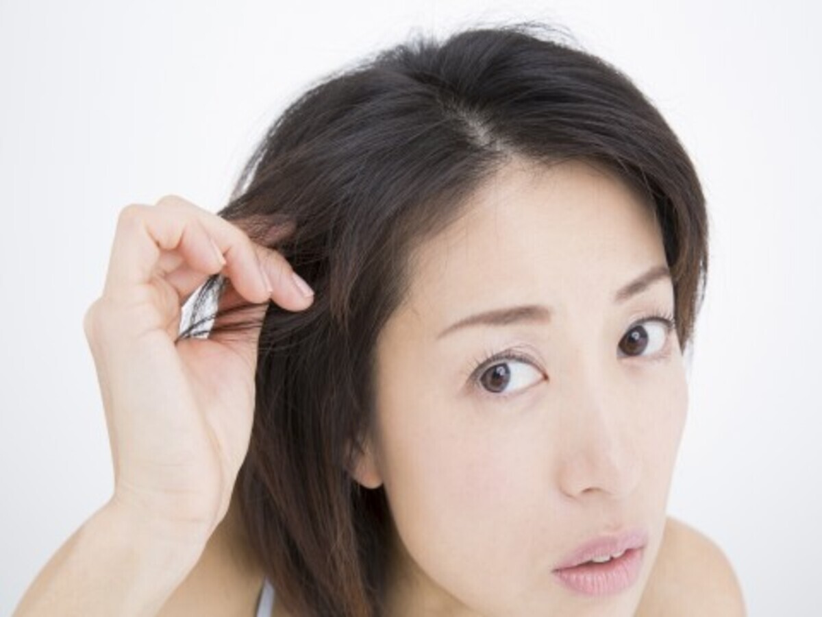 びまん性脱毛症の原因と治療法 ウーマンエキサイト 1 4